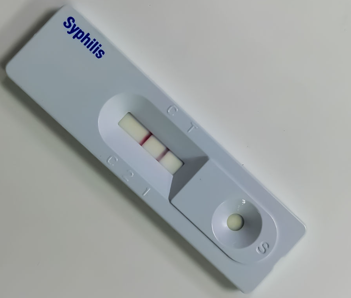 Sifilis antigen sürətli test zolağı